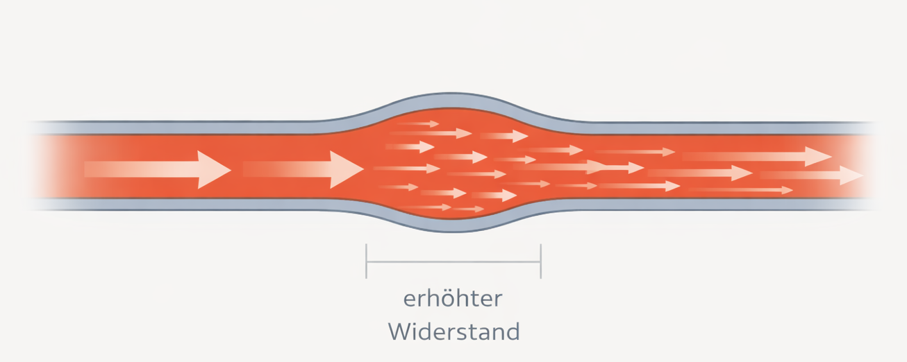 Gefäßwiderstand und Blutdruck – Vergleich zwischen weitem und engem Blutgefäß