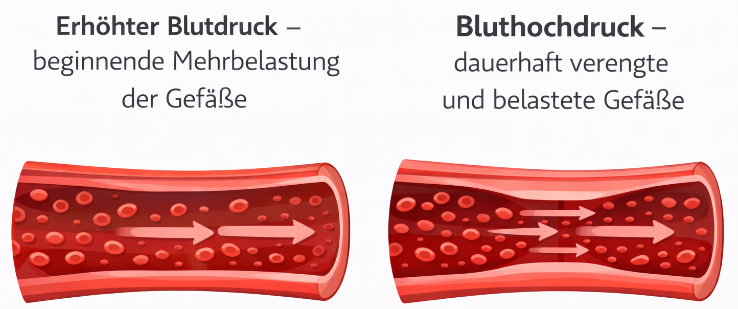 Erhöhter Blutdruck vs Bluthochdruck